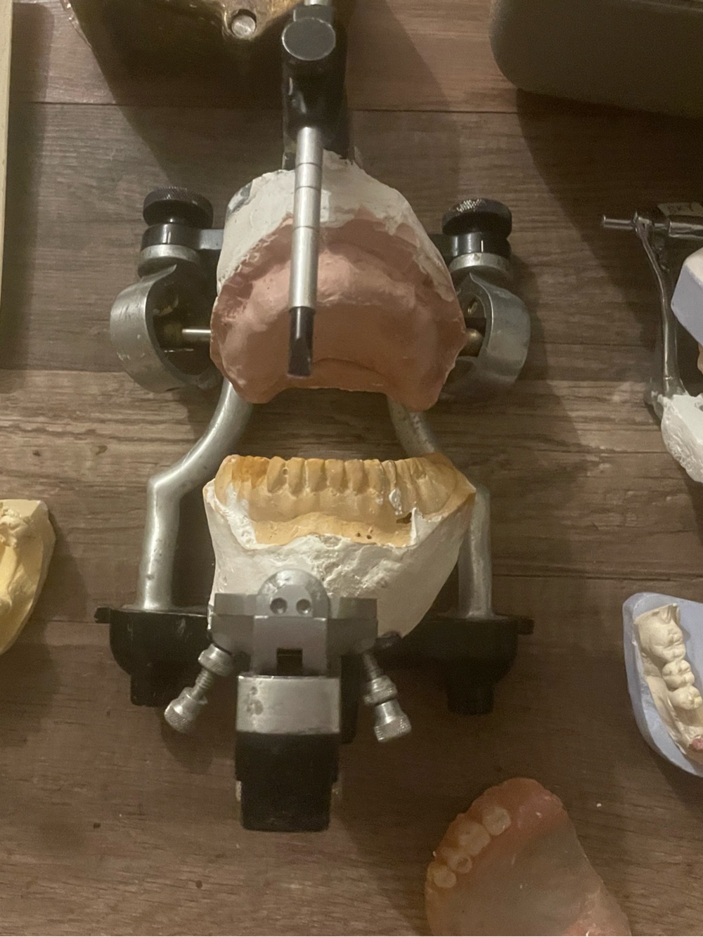 Vintage Dental Articulator with Upper and Lower Plaster Models - Beige/White